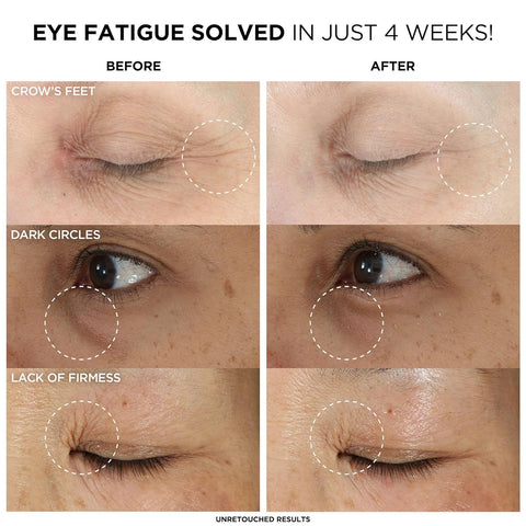IT Cosmetics Confidence in an Eye Cream, anti Aging Eye Cream for Dark Circles, Crow'S Feet, Lack of Firmness & Dryness, 48HR Hydration with 2% Super Peptide Concentrate, for Day + Night
