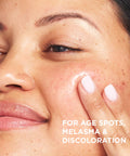 IT Cosmetics Bye Bye Dark Spots 4% Niacinamide Serum - Visibly Reduces Dark Spots & Improves Skin Clarity in 8 Weeks - with 1% Ethyl Vitamin C - for All Skin Types - 1 Fl Oz