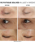 IT Cosmetics Confidence in an Eye Cream, anti Aging Eye Cream for Dark Circles, Crow'S Feet, Lack of Firmness & Dryness, 48HR Hydration with 2% Super Peptide Concentrate, for Day + Night