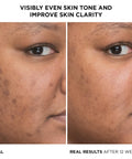 IT Cosmetics Bye Bye Dark Spots 4% Niacinamide Serum - Visibly Reduces Dark Spots & Improves Skin Clarity in 8 Weeks - with 1% Ethyl Vitamin C - for All Skin Types - 1 Fl Oz
